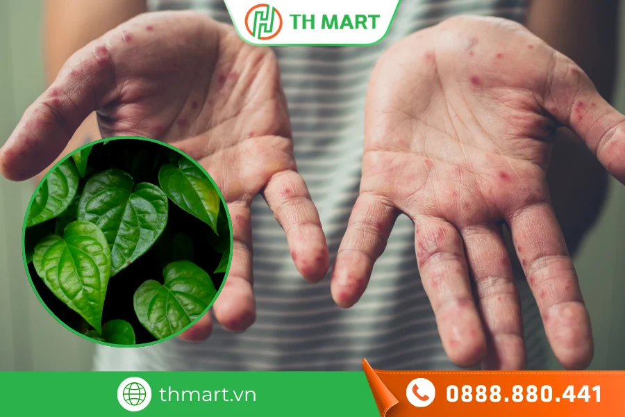 Trẻ bị chân tay miệng tắm lá trầu không được không?