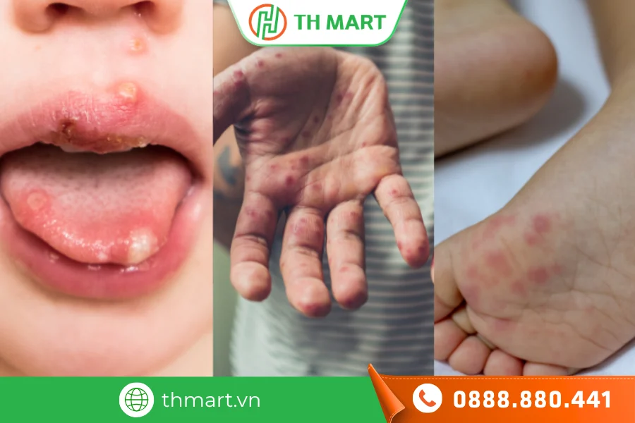 Tắm lá trầu không sai cách có thể gây biến chứng da